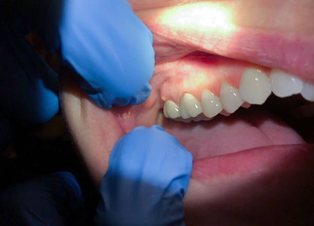 Best Emergency Gum Pain Relief  in Lyons, NJ